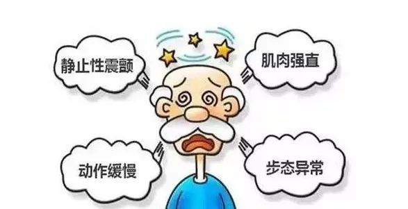 帕金森病,又称震颤麻痹,是最常见的神经系统退行性疾病之一,临床上