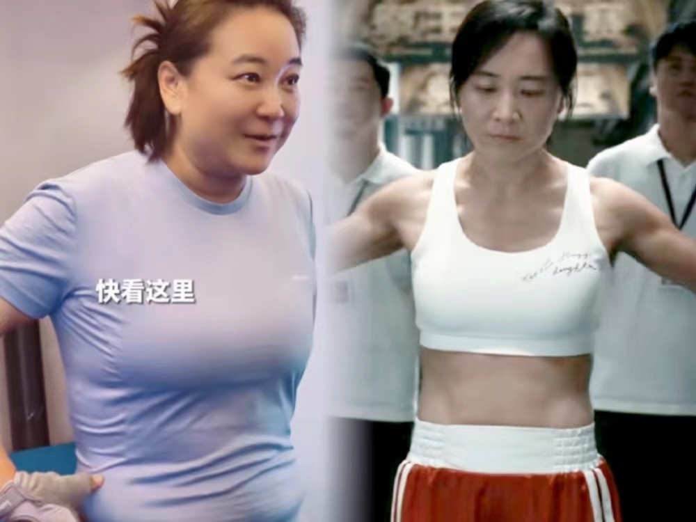 手術減肥_減肥手術是怎么做的_減肥手術多少錢