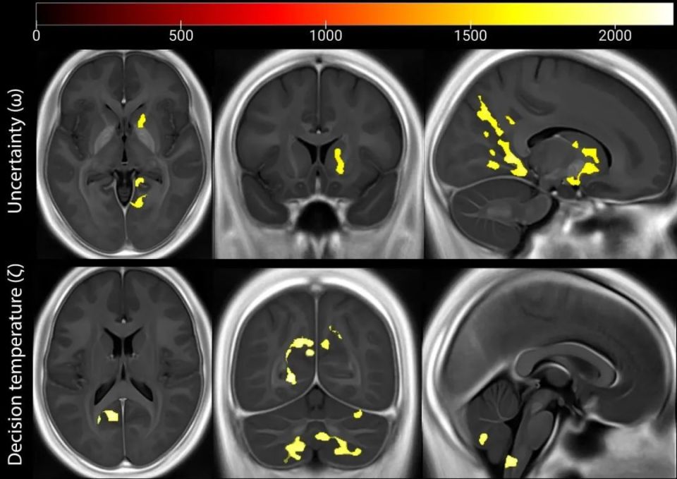 以色列医疗设备有哪些追问weekly ｜ 过去一周，脑科学领域有哪些新发现？Vol.63_https://www.jmylbn.com_新闻资讯_第15张