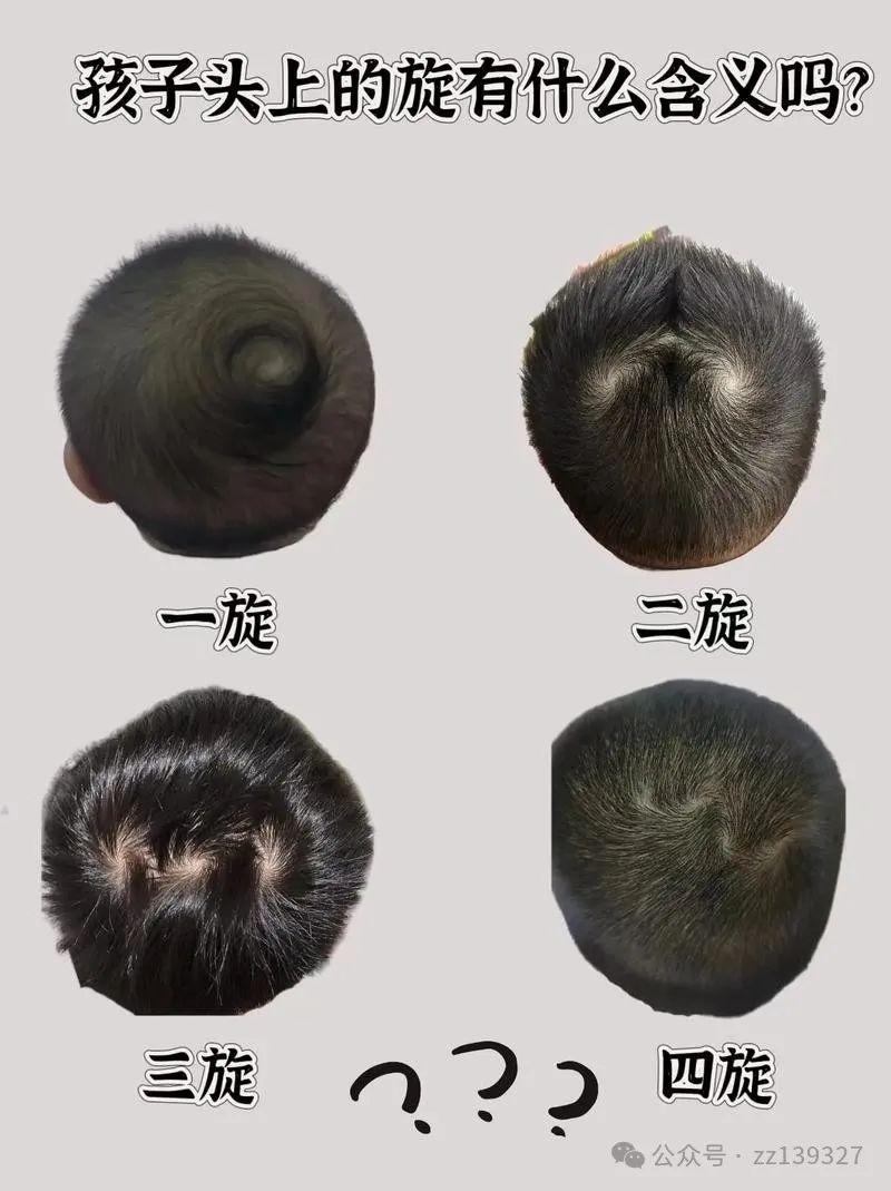 一旋横二旋楞，三旋打架不要命，头顶上的旋，到底有什么讲究？_腾讯新闻