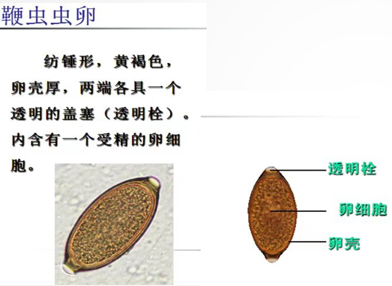 鞭虫卵结构示意图标注图片