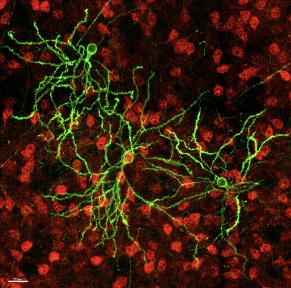 小鼠脑定位怎么固定追问daily ｜ 呼吸妙用：吸气接收线索，呼气重构记忆；动物有情感但无“人样”思维；使用食物揭示AI文化盲点与区域偏见_https://www.jmylbn.com_新闻资讯_第5张
