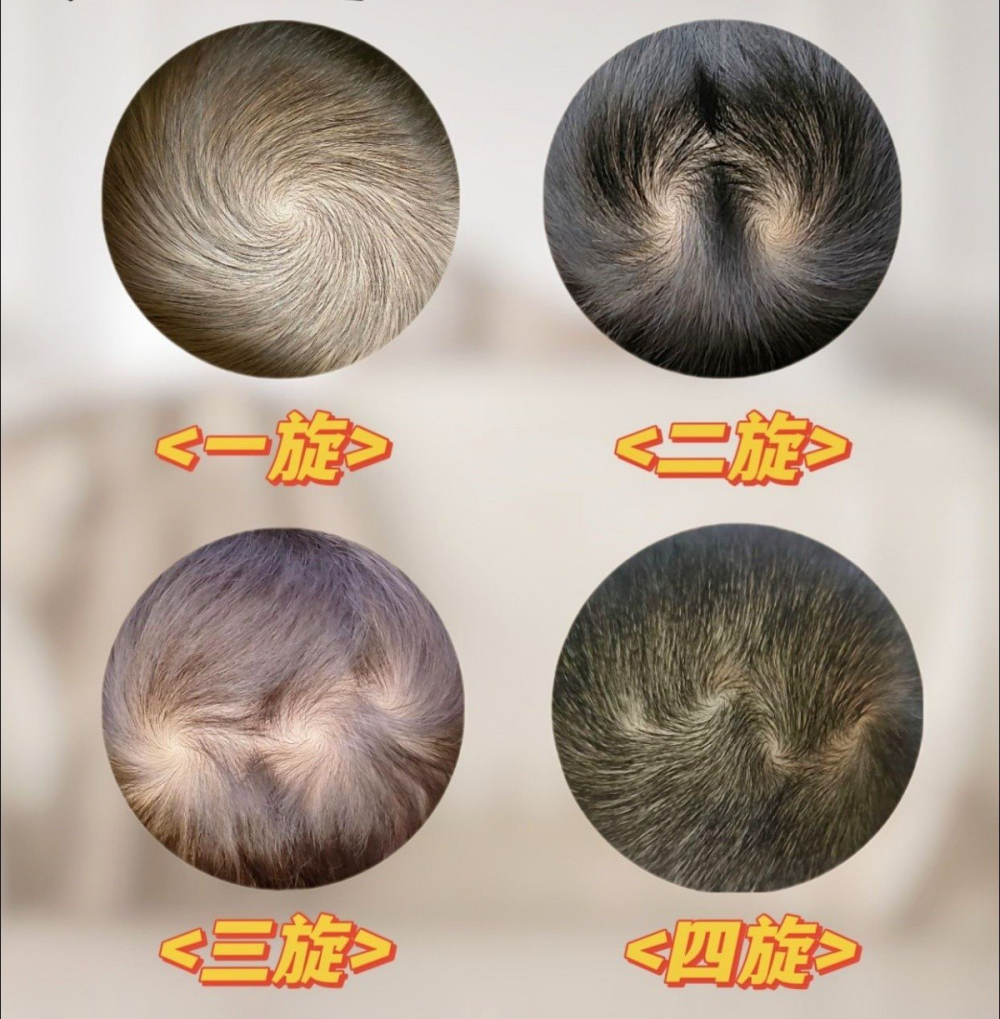 孩子智商高不高,看头上几个"旋"就知道?听听科学的解答就明白了