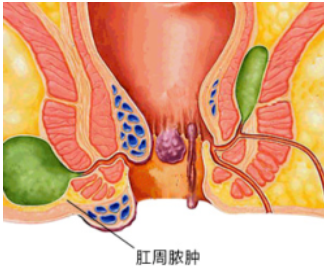 火疖子内部结构图图片