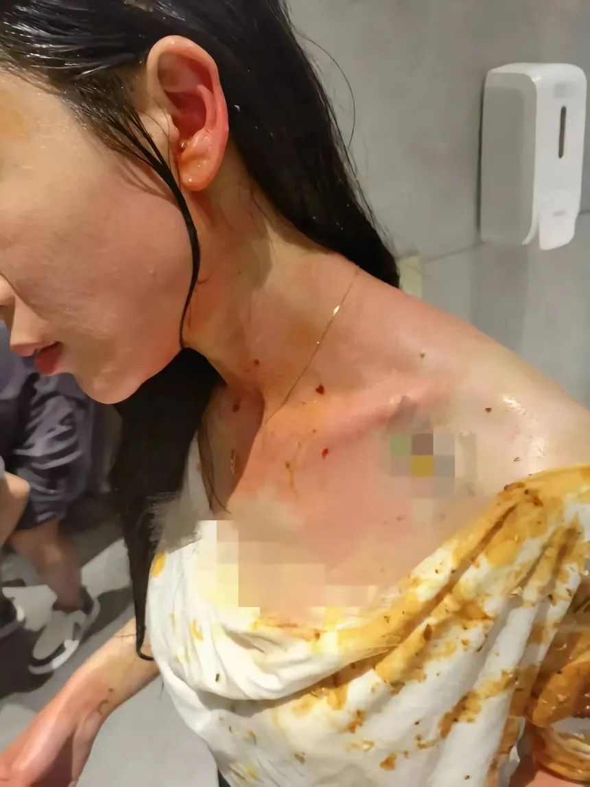 专访两年被家暴16次当事人:如今我不止为自己而活