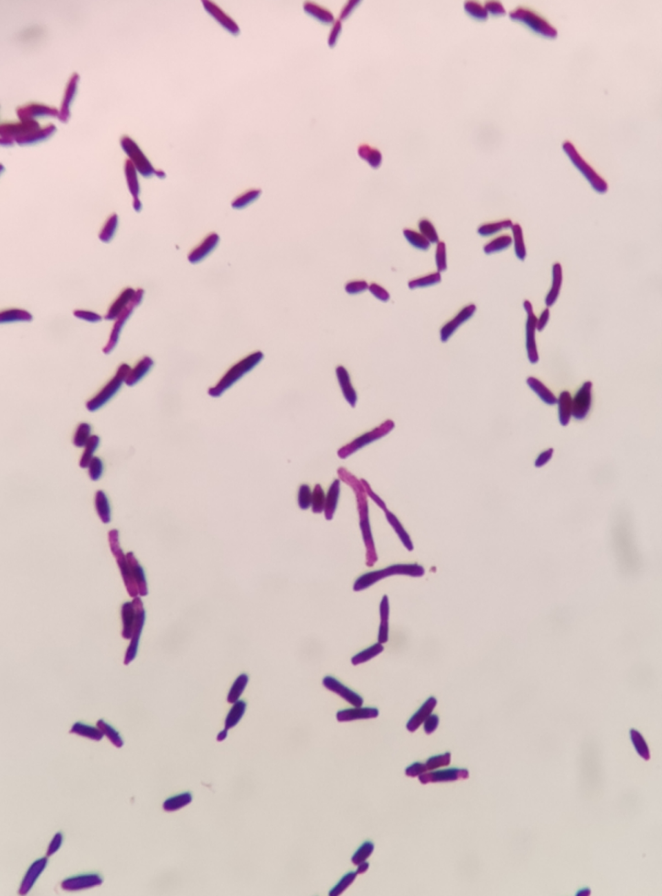 但生长不良,延长培养至3d,菌落呈奶油色酵母样,表面有干燥粉状物,长老