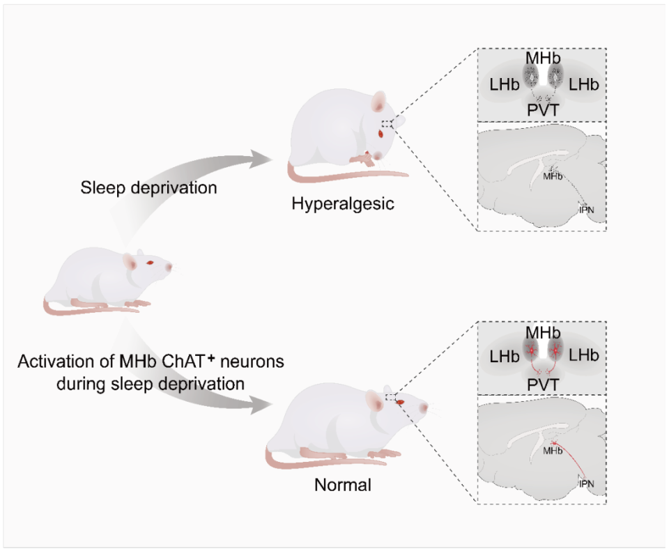 Neurosci Bull最新︱北京大学王韵教授：内侧缰核胆碱能神经元介导睡眠剥夺引起的痛觉过敏_腾讯新闻