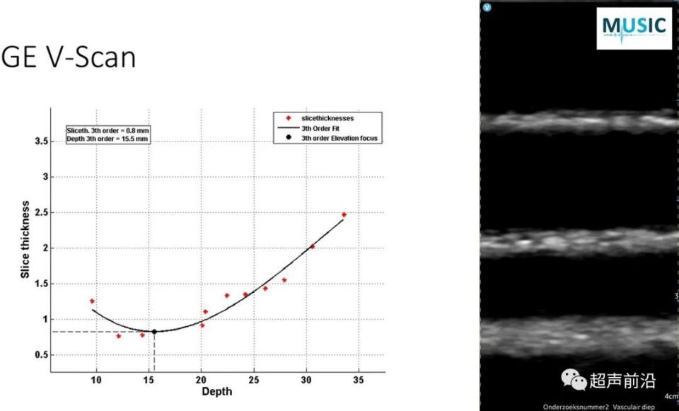 ge医疗器械怎么样GE vs 飞利浦 vs Butterfly ： 手持超声参数差异对比_https://www.jmylbn.com_新闻资讯_第8张