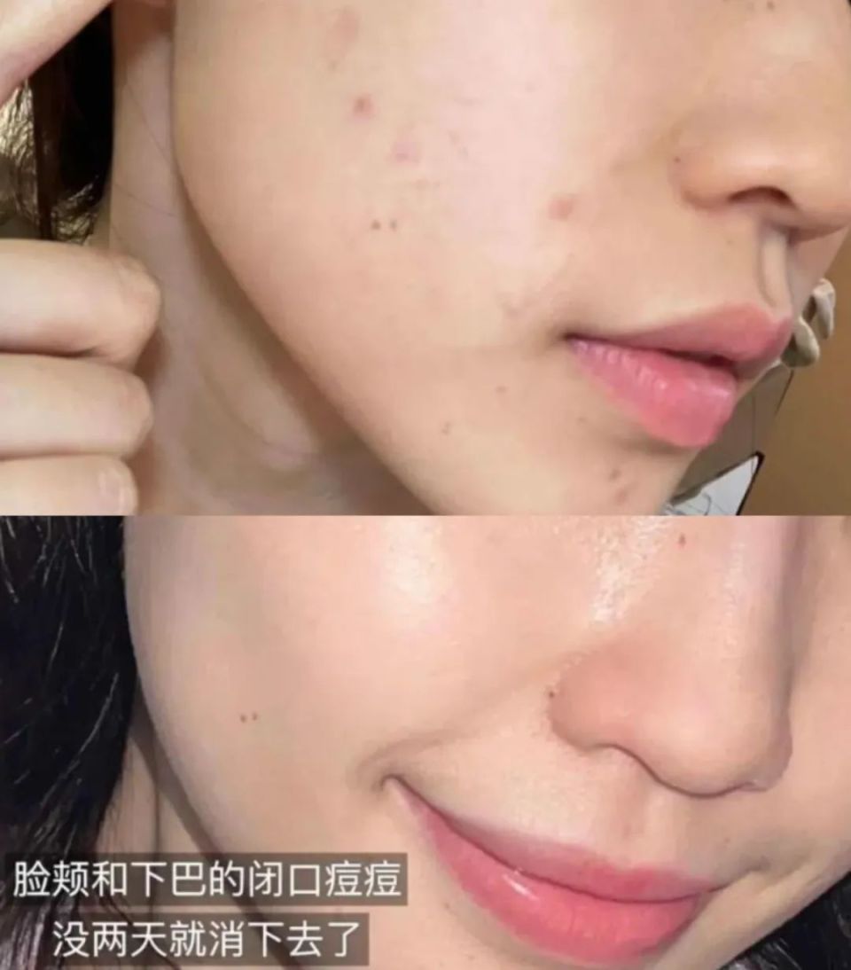 用之后:直接改名闭口橡皮擦吧_腾讯新闻