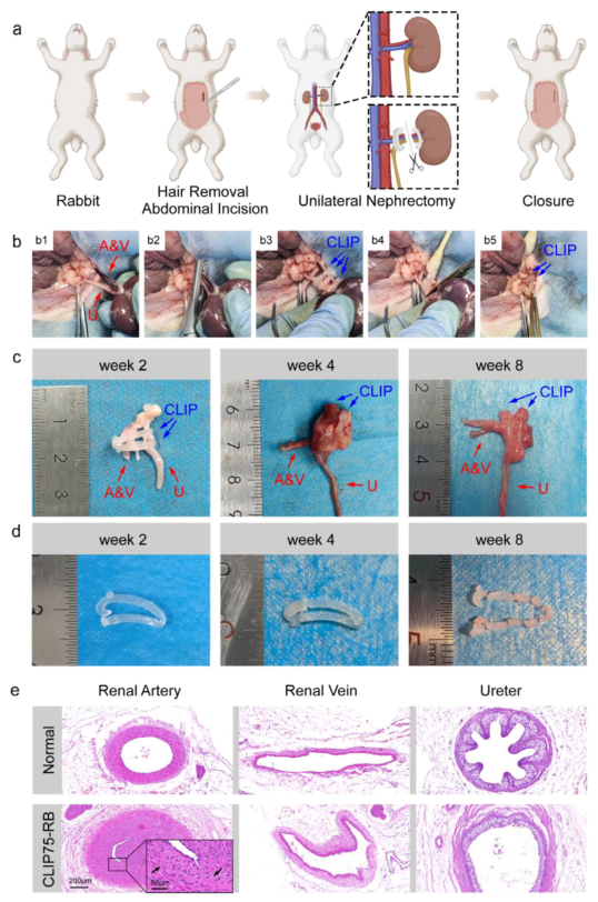 什么是可吸收夹四川大学何斌、成都大学高文霞AM：新型可降解共聚物为高性能组织结扎夹带来革新_https://www.jmylbn.com_新闻资讯_第12张