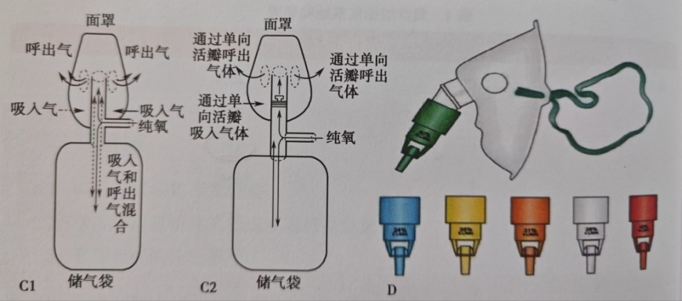吸氧装置怎么使用鼻导管吸氧最大可以给到多少氧流量？对应多少氧浓度？_https://www.jmylbn.com_新闻资讯_第3张