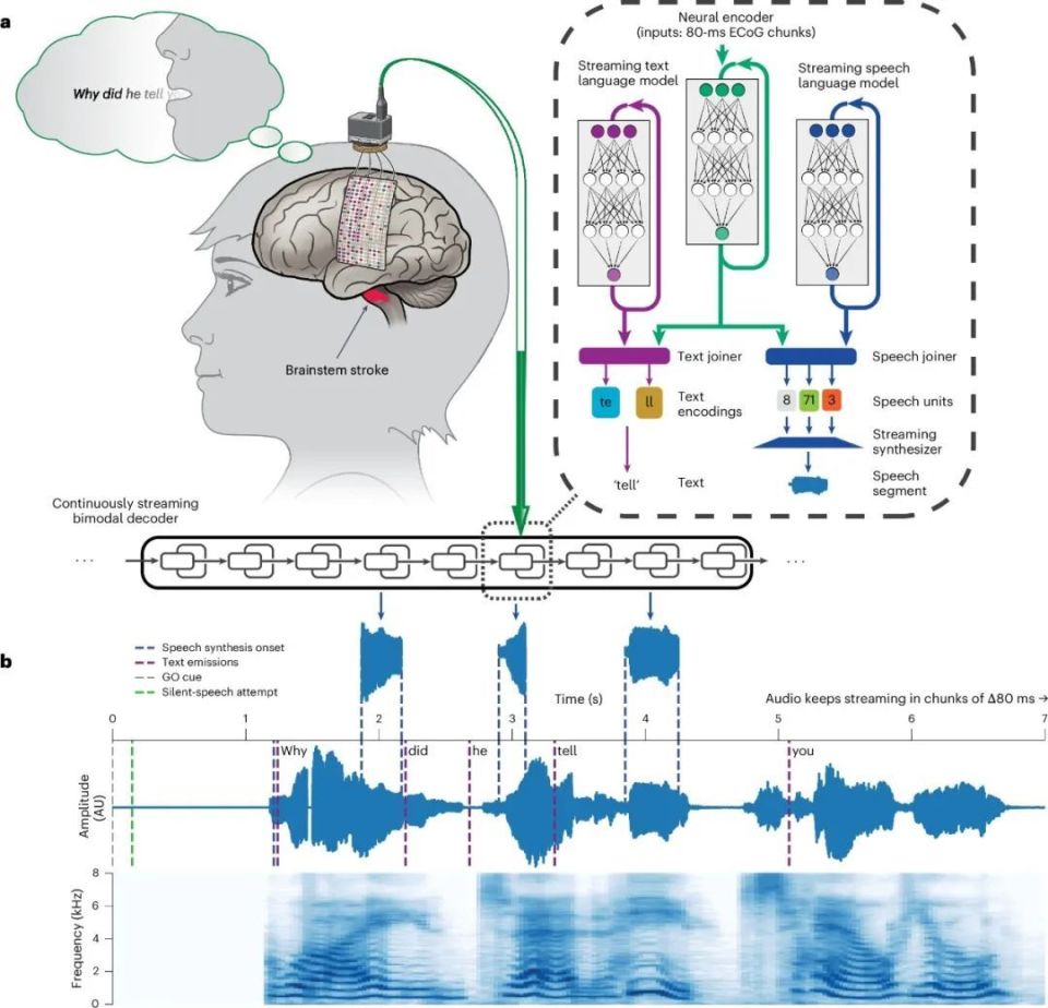 心电图机器怎么看追问weekly ｜ 过去一周，脑科学领域有哪些新发现？_https://www.jmylbn.com_新闻资讯_第34张