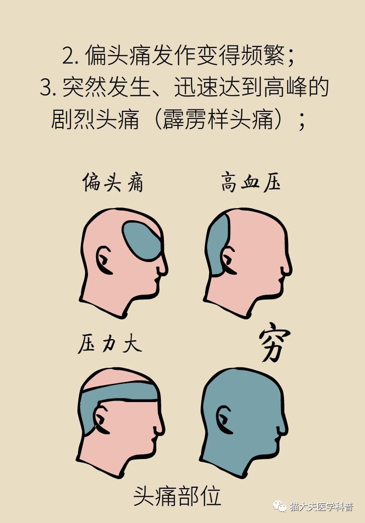 偏头痛一言不合就发作,怎么办?牢记9字口诀