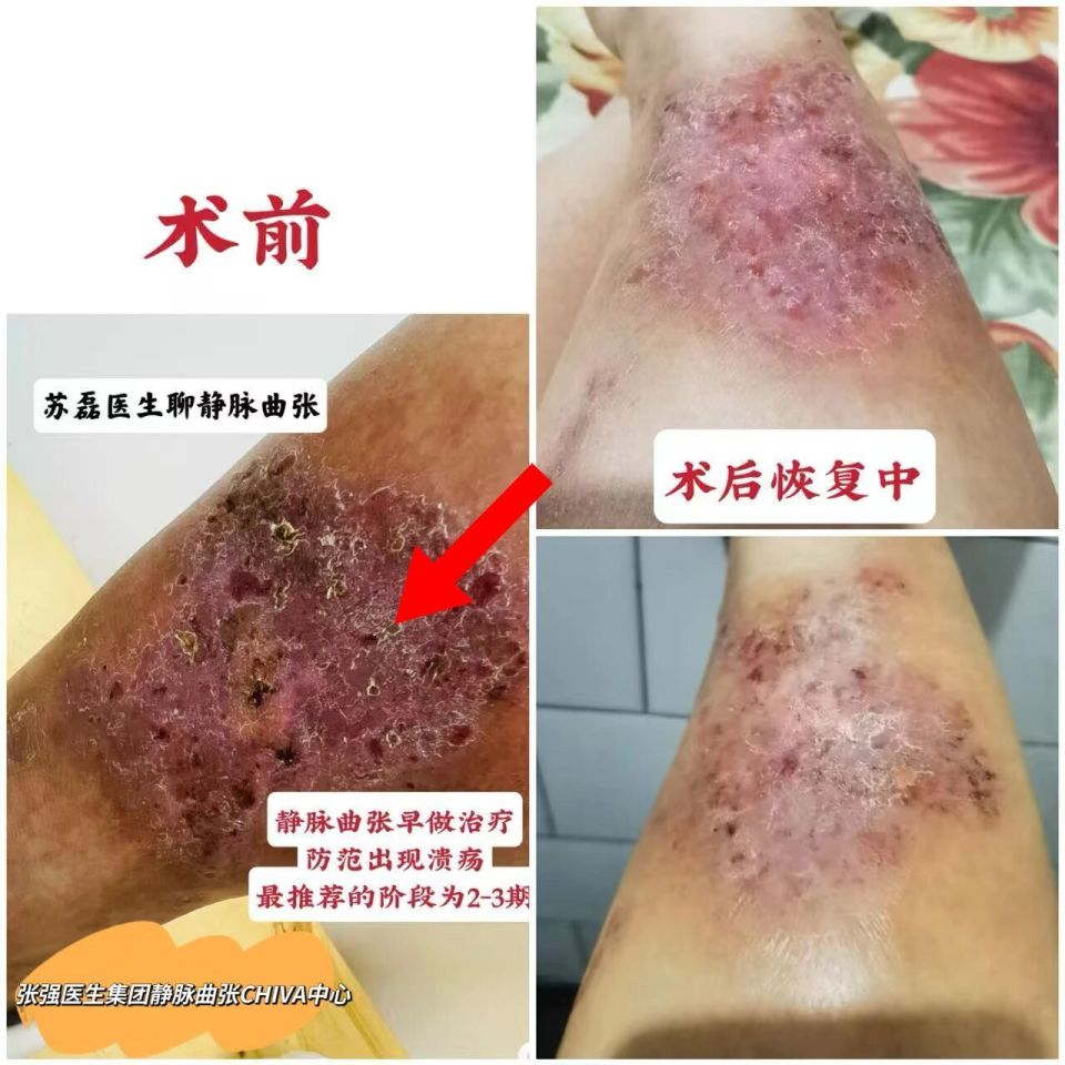 关于地坛医院住院办理陪诊挂号复杂病情综合分析，治疗方向更明确的信息