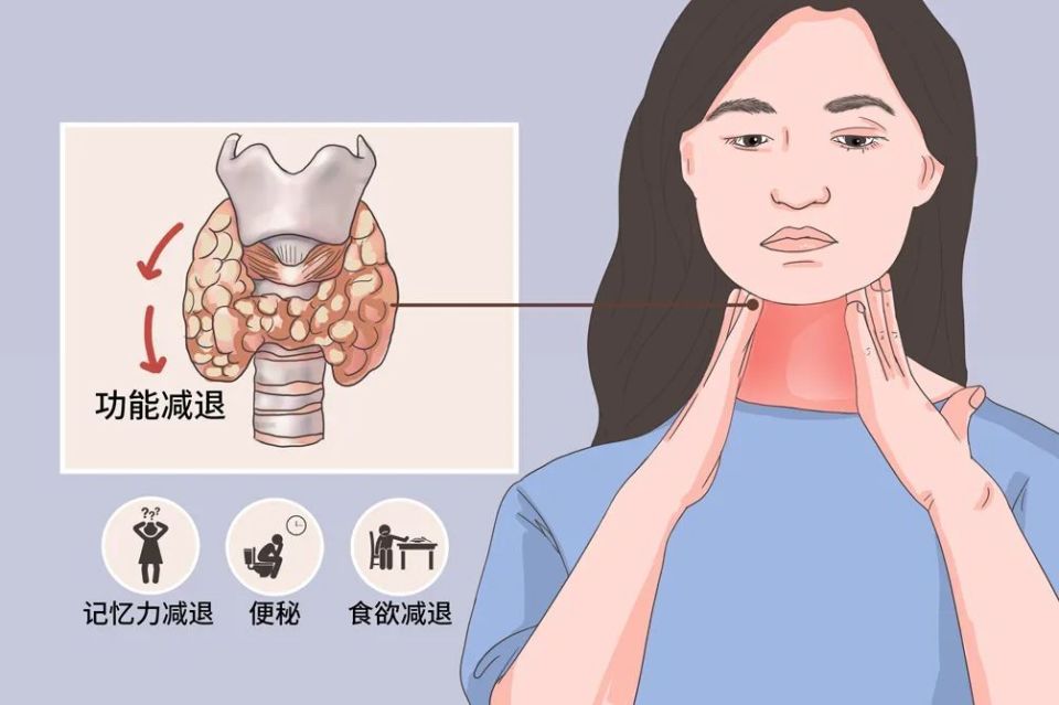 桥本氏甲状腺炎"重女轻男",到底要不要治?
