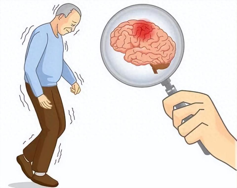 并得出一个令人惊讶的统计数据:中风,或在医学上称之为"脑卒中",是