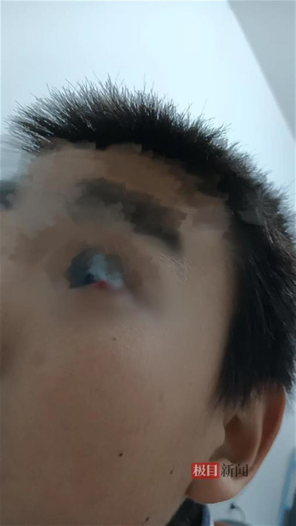其10岁的儿子在学校遭到一名副校长拳打,导致孩子眼球出血和脑震荡
