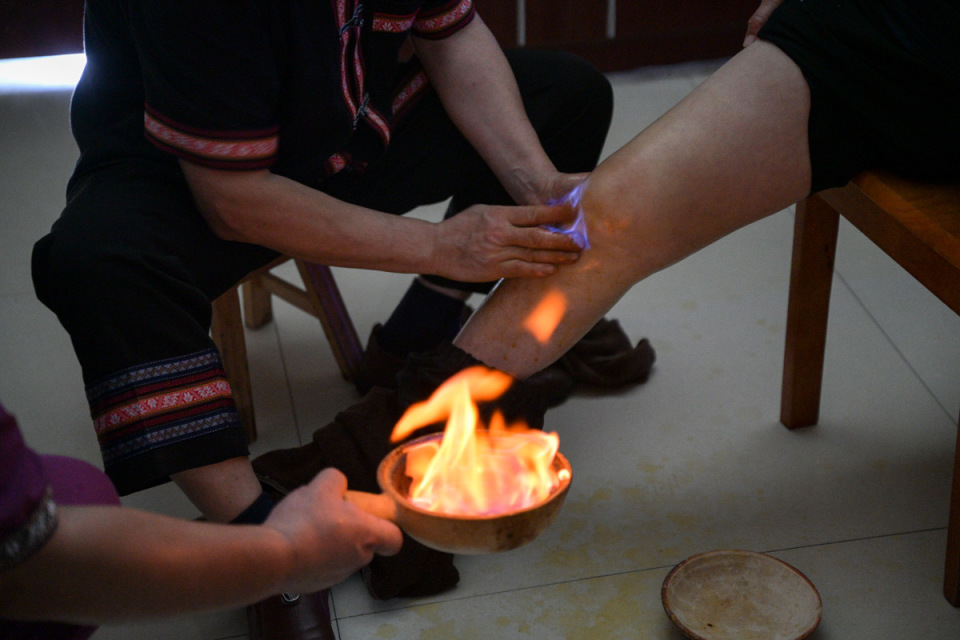 "徒手抓火"做推拿,"豪猪箭"从原始社会流传至今,永