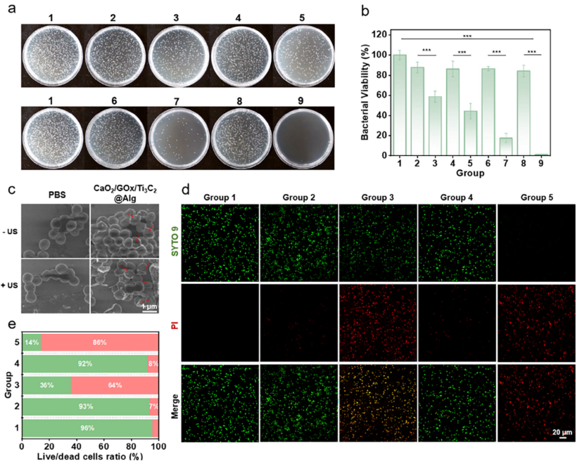 医用抗菌水凝胶怎么用南京工业大学AFM：新型可注射水凝胶为糖尿病脓肿治疗提供级联抗菌新策略_https://www.jmylbn.com_新闻资讯_第6张