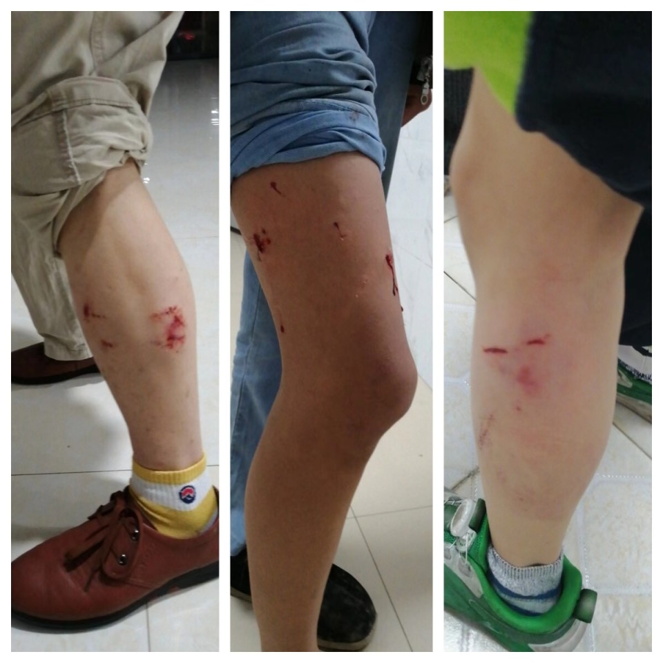 据知情人向大皖新闻记者透露,当时咬人的狗不止一条,朝阳市场有十多人