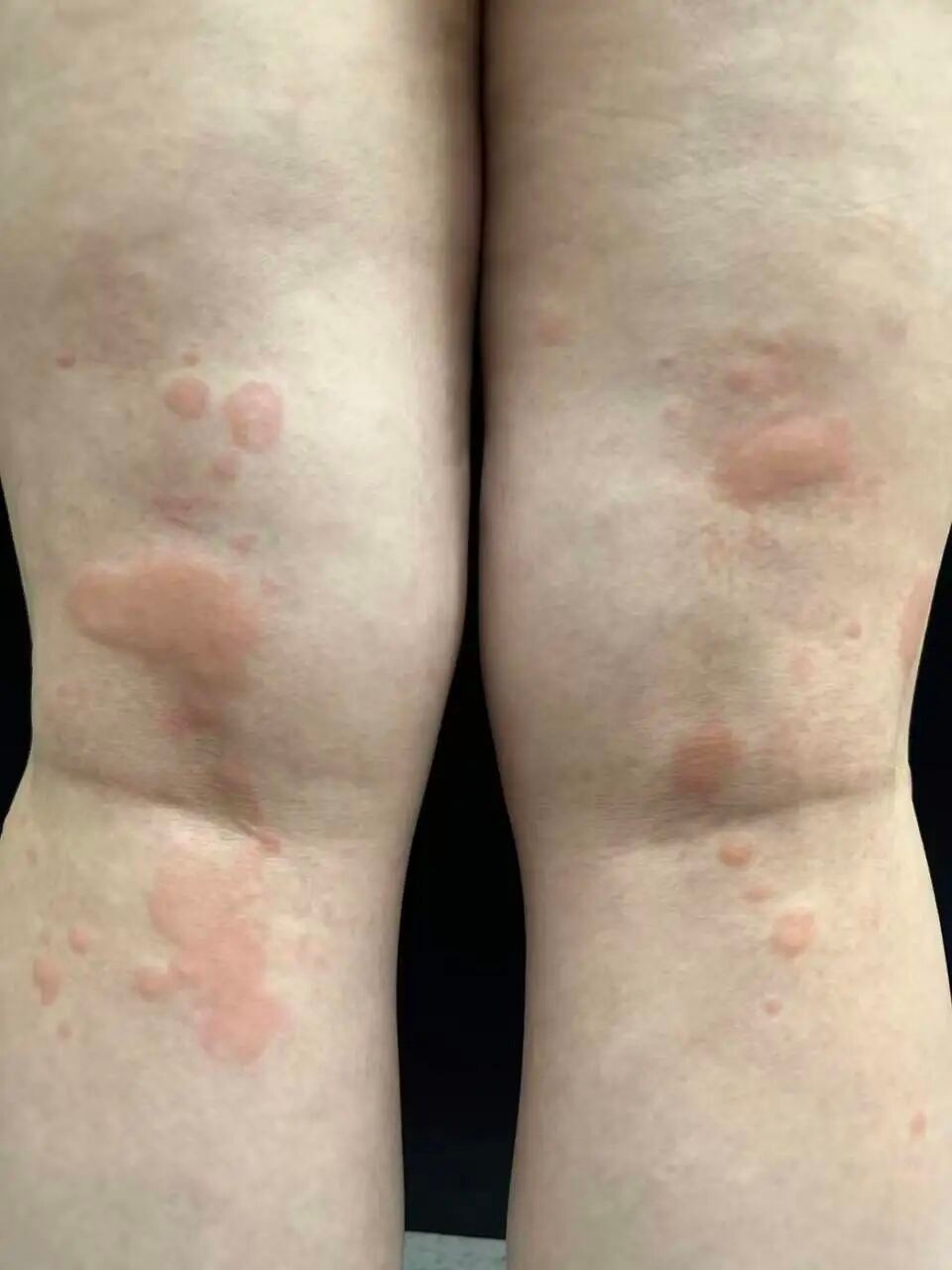 台州35岁男子被确诊，医生提醒：注意温度与情绪变化-腾讯新闻