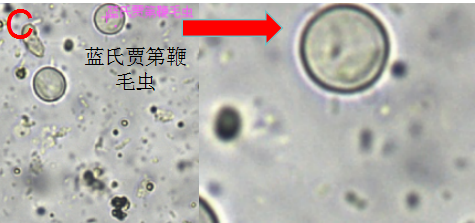 大便镜检寄生虫图片