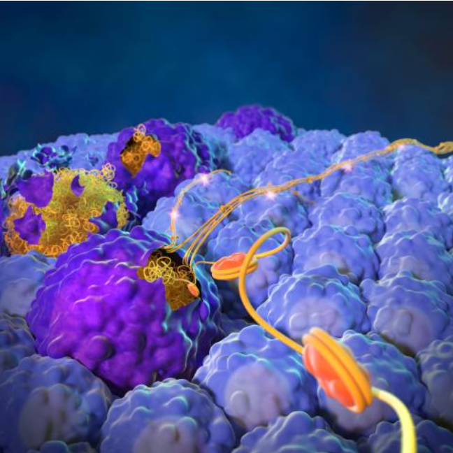 前沿 | Nature Cancer：癌细胞的“临终遗言”加速癌转移！新发现或改变癌症治疗结局？_腾讯新闻
