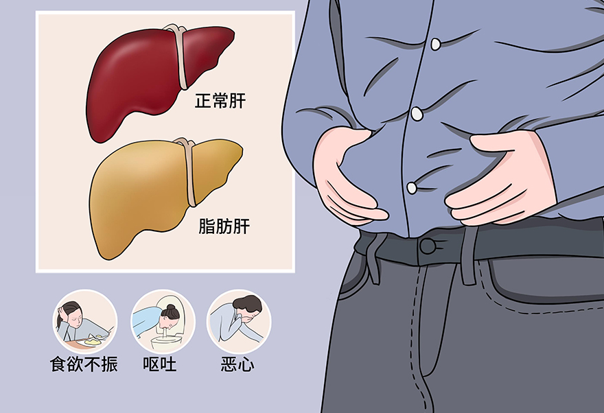 专家为你揭秘如何远离"脂肪肝"