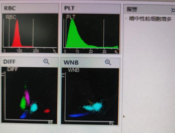 尿沉渣仪器怎么使用检验报告审核“十大坑”！90%的检验人都逃不掉..._https://www.jmylbn.com_新闻资讯_第2张