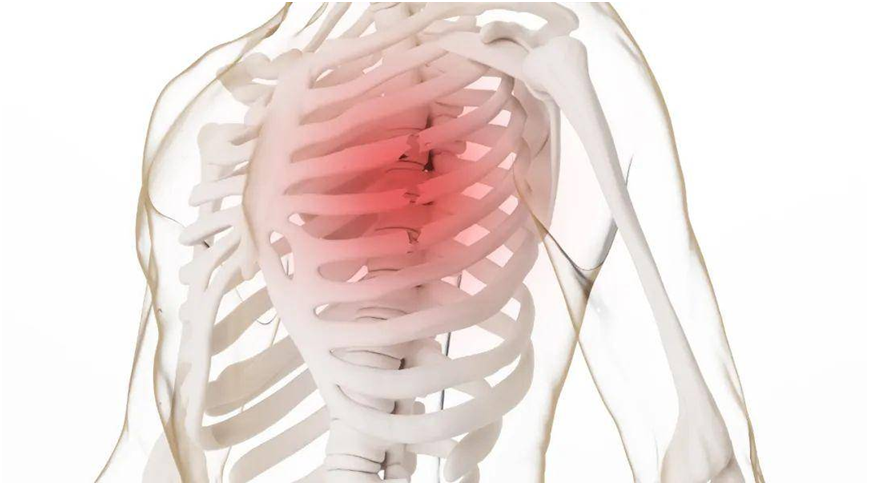 肋骨骨折了怎么办?