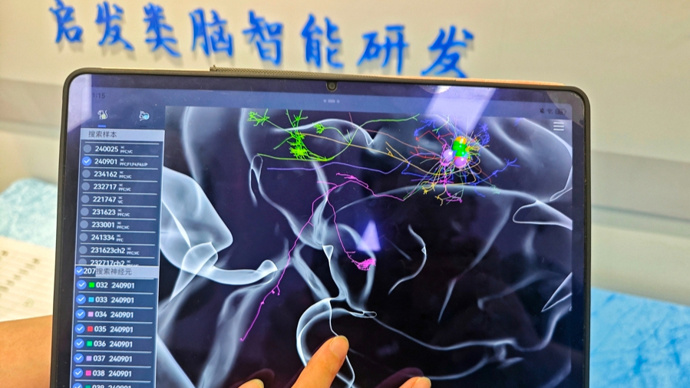 绘制精细人脑图谱意义重大！中国科学家为何要在这张图上钻牛角尖？