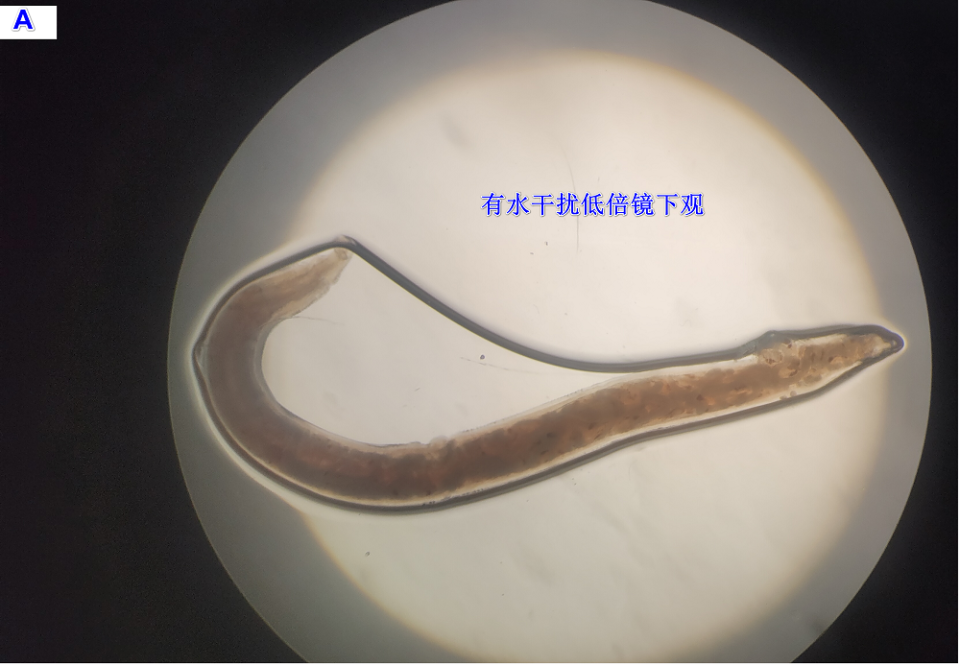 患者胃里很多虫子!还活着,在动!_腾讯新闻