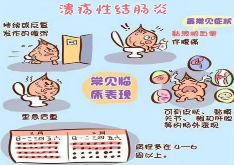 主要症状:反复腹泻,粘液脓血便,里急后重,左下腹痛;患有溃疡性结肠炎