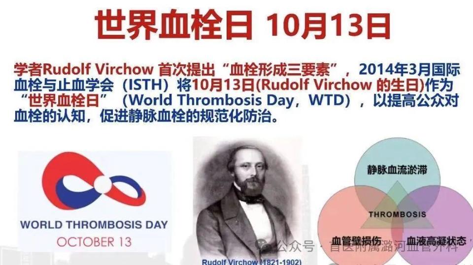 世界血栓日——动起来，别让血栓 “栓” 住你！_腾讯新闻
