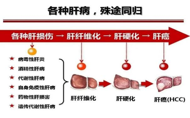 甲型肝炎临床表现图片