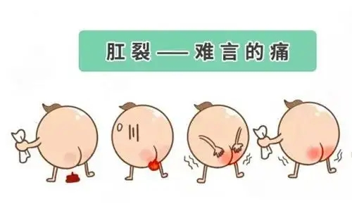 初起是肛管皮肤纵行裂口,呈线形或棱形,边软整齐,底浅有弹性,反复感染