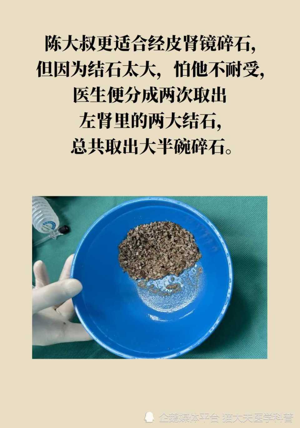 男人得了肾结石就废了图片