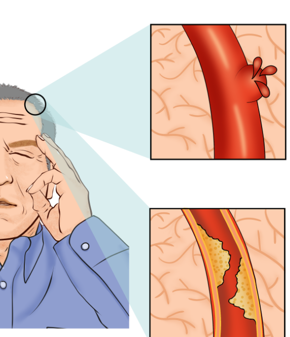 "名院名医话健康@哈密市中心医院"系列4||援疆专家支招:夏季高温来袭