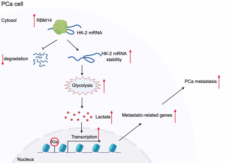 Cell Death Discov | 乳酸不只是代谢废物：RBM14通过H3K18乳酰化促进前列腺癌转移_腾讯新闻