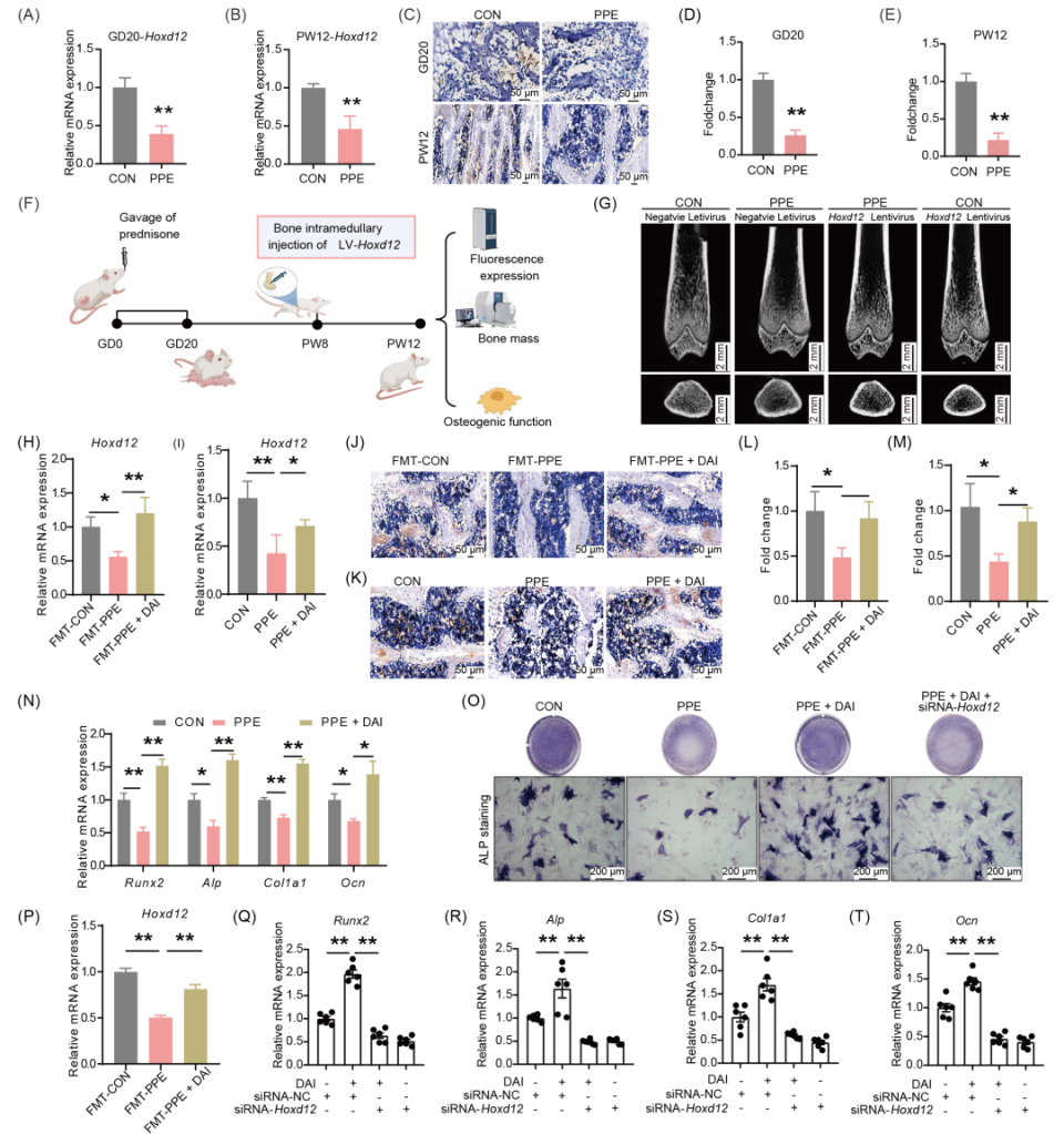 iMeta | 武汉大学汪晖/陈廖斌组：解析母体肠道菌群稳态、表观遗传调控机制与子代骨质疏松症易感之间的三元关系-腾讯新闻