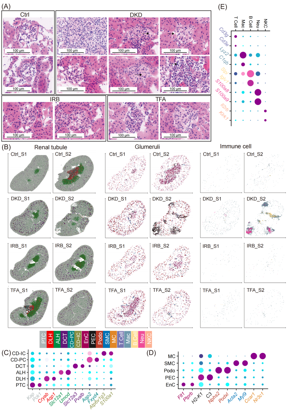 透化治疗什么iMeta ｜ 中国药科大学顾丰组-解析黄葵治疗糖尿病肾病机制_https://www.jmylbn.com_新闻资讯_第3张