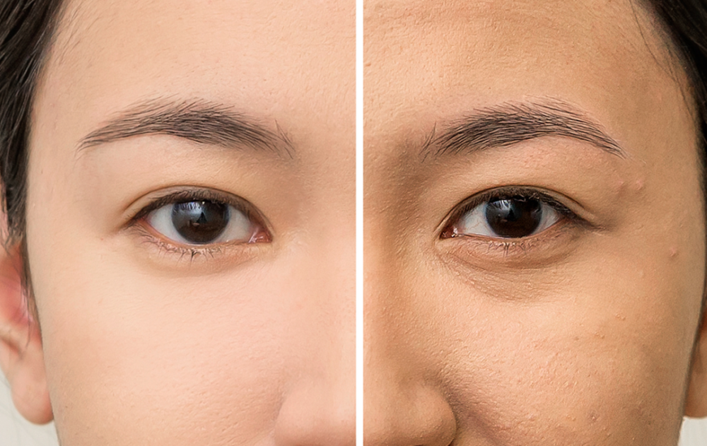 想让眼睛老得慢一点,这法子越早知道越好