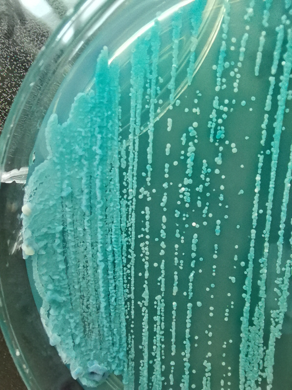 尿液分离出阿萨希毛孢子菌1例报道