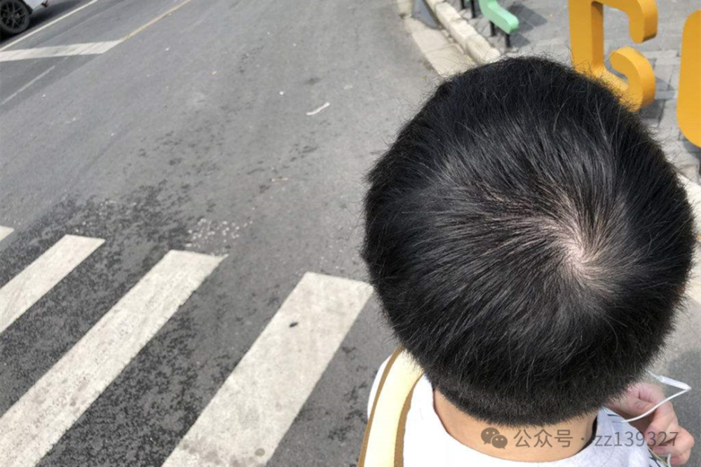 一旋横二旋楞，三旋打架不要命，头顶上的旋，到底有什么讲究？_腾讯新闻