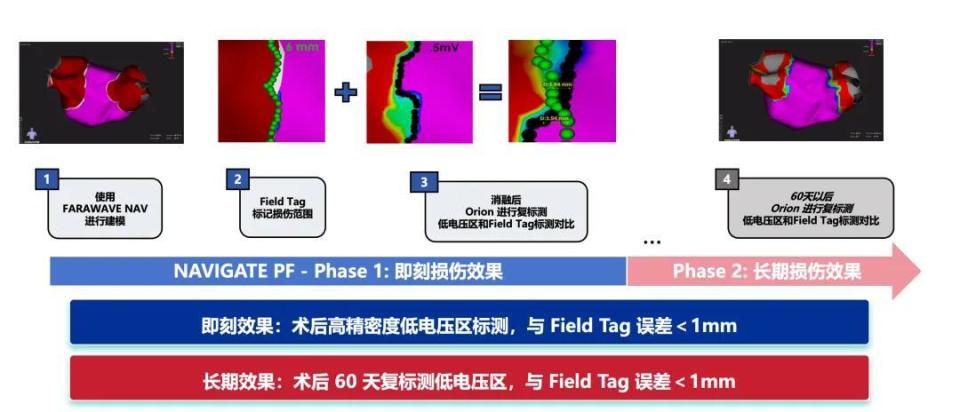 波科FARAVIEW三维系统获批，PFA技术竞争进入新阶段_腾讯新闻