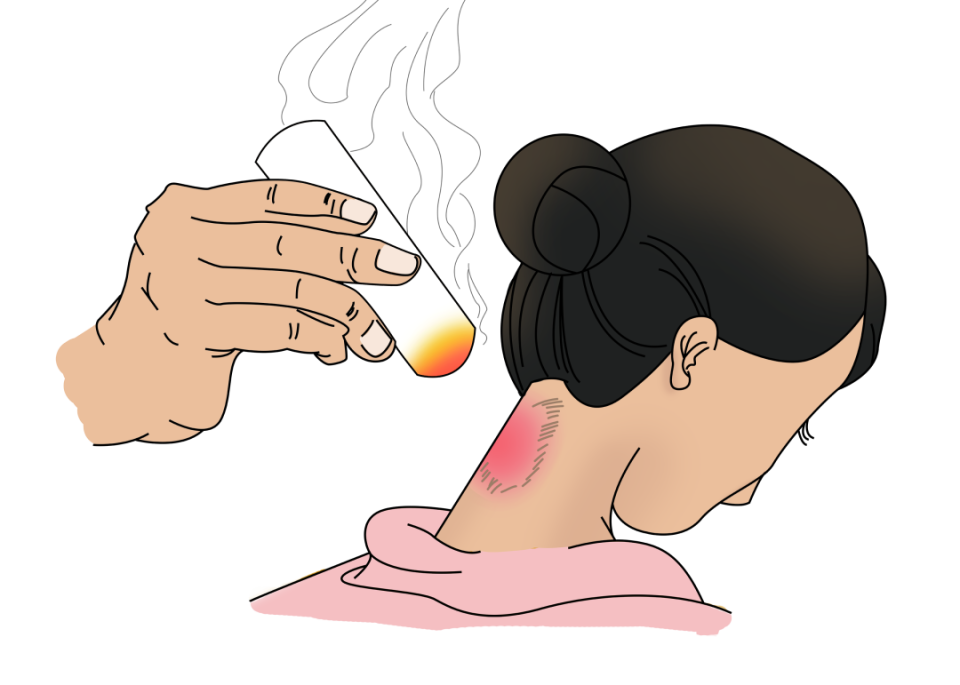 想自己在家艾灸?这几点一定要注意