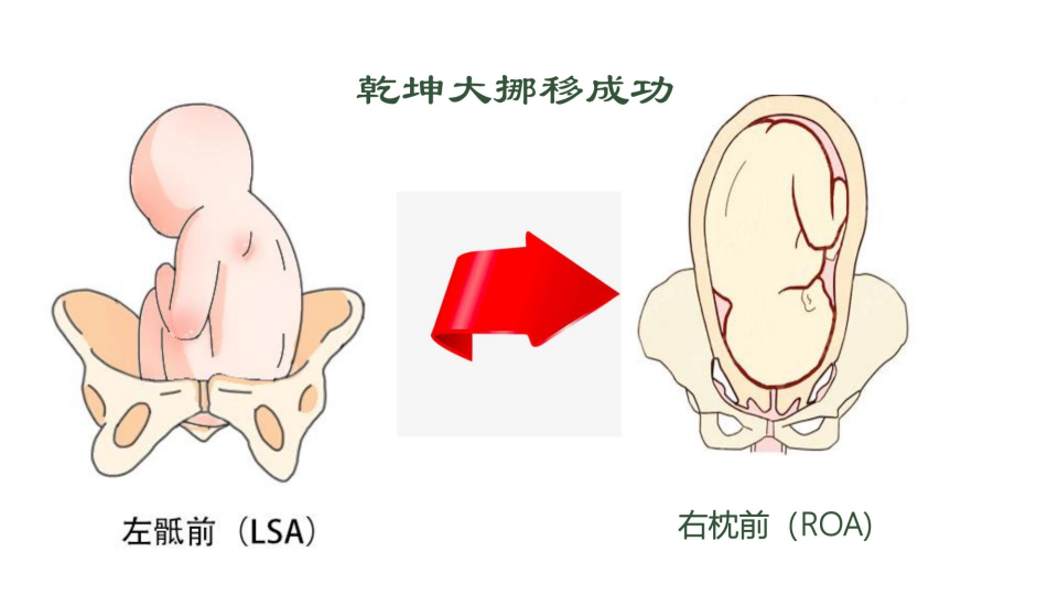 宝宝在妈妈肚皮里的神奇乾坤大挪移
