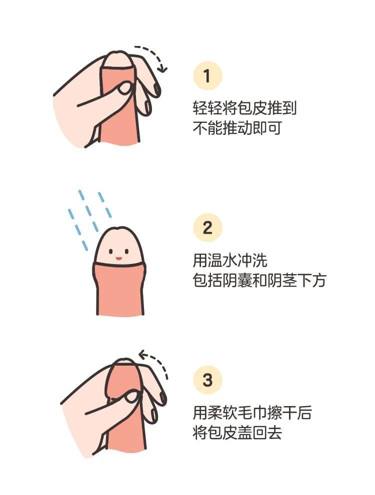 男宝私处说明书:包皮,蛋蛋,小 jj,这些问题必须得知道