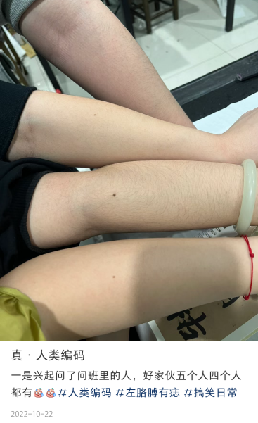 网友认为这颗小小黑痣背后发现自己手臂上居然也有"人类编码"一撸袖子
