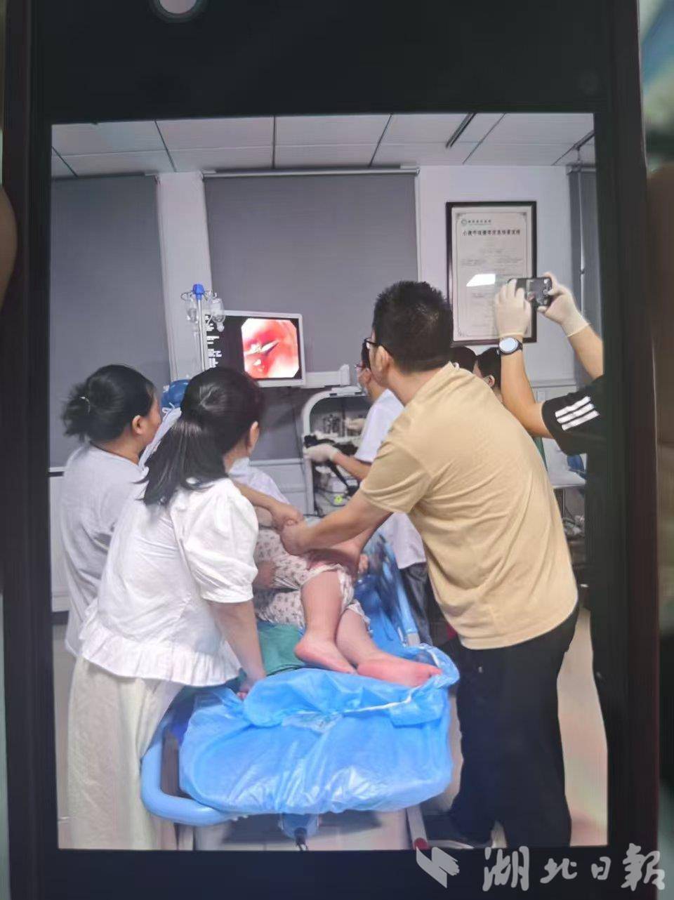 崇阳10岁女孩误吞1元硬币！返乡“85”后医生3分钟成功取出-腾讯新闻